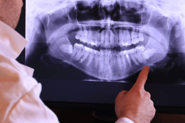 Best After-Hours Emergency Dentist in Fort Recovery, OH