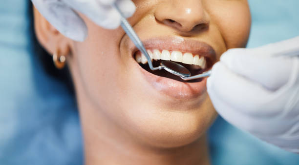 Best Emergency Tooth Extraction in Fort Recovery, OH