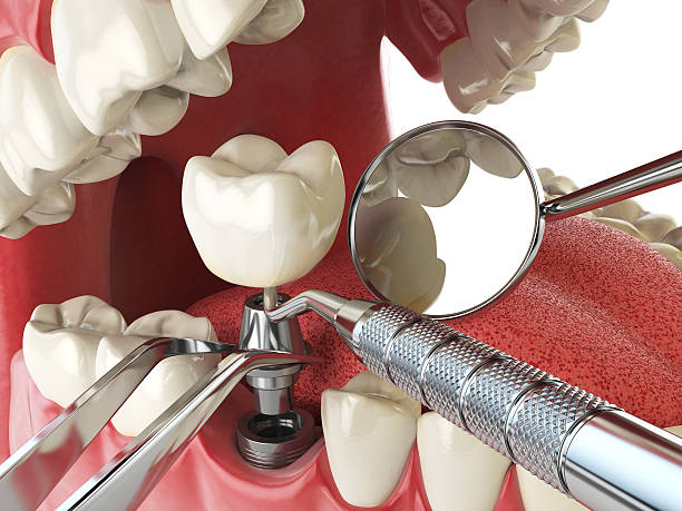 Best Walk-In Emergency Dentist in Fort Recovery, OH